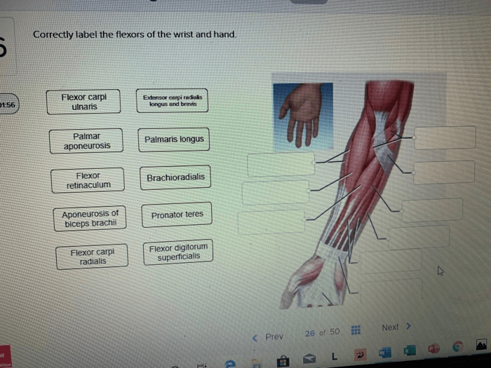 Correctly label the flexors of the wrist and hand