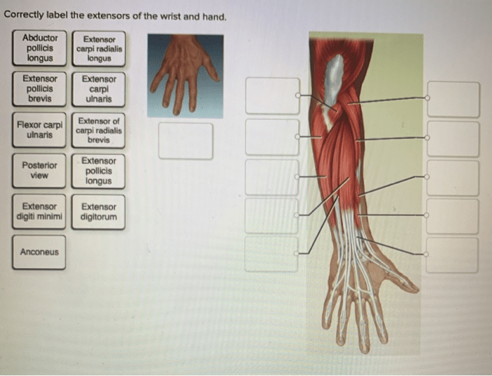 Correctly label the flexors of the wrist and hand